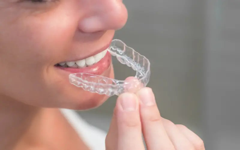 Orthodontic treatment with clear aligners