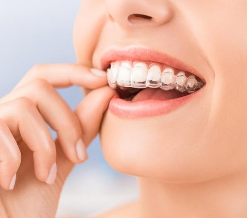 SmileAdvantage Plus