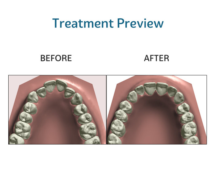 SmileAdvantage Plus