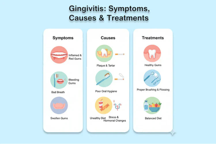 Eine Abbildung zeigt Symptome, Ursachen und Behandlung von Gingivitis.