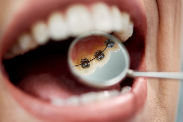 Eine lächelnde Frau mit Klasse, die mich anbeißt.