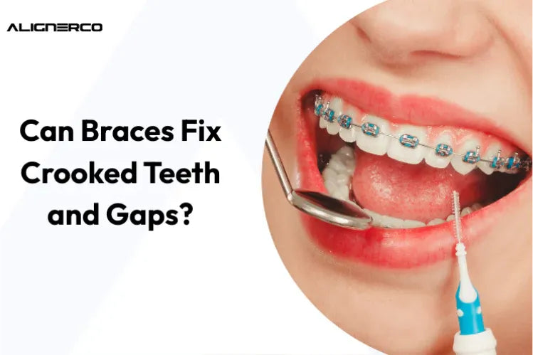 Ein Mädchen mit farbigen Metallspangen zur Zahnkorrektur.