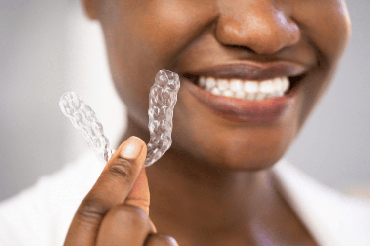  clear aligners 